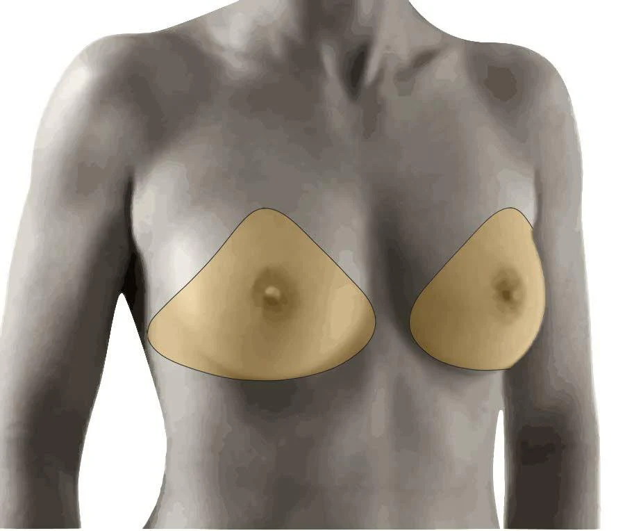 Amoena Natura 2A Light Breast Form 392 - Image 4