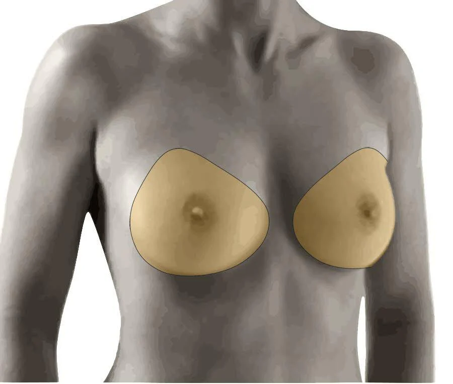 Amoena Natura 3E Breast Form 397 - Image 3